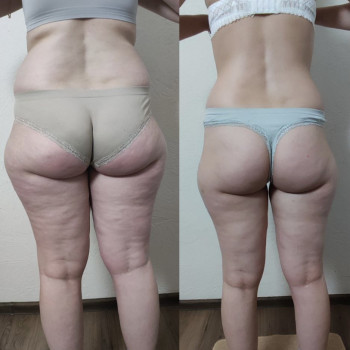 Марія Хропункова, Одеса Фото - 24