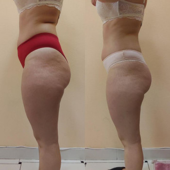 Марія Хропункова, Одеса Фото - 26