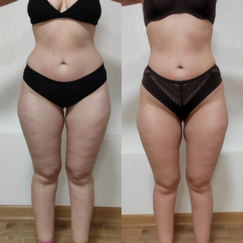 Марія Хропункова, Одеса Фото - 27