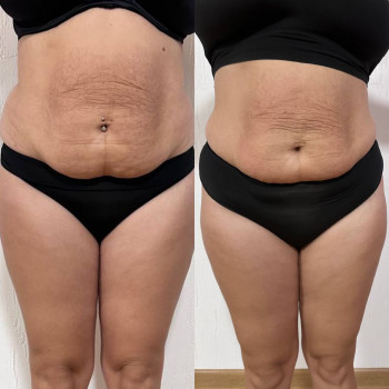 Марія Хропункова, Одеса Фото - 29