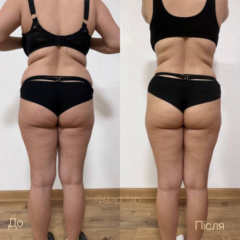 Марія Хропункова, Одеса Фото - 30