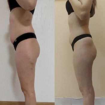 Марія Хропункова, Одеса Фото - 31