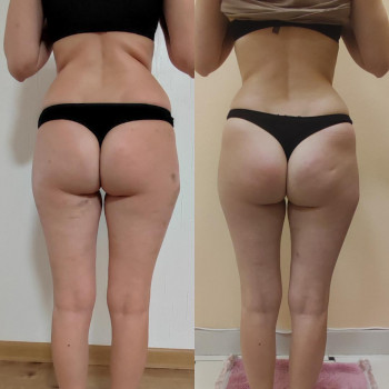 Марія Хропункова, Одеса Фото - 32