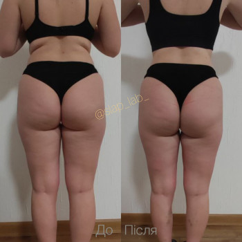 Марія Хропункова, Одеса Фото - 33