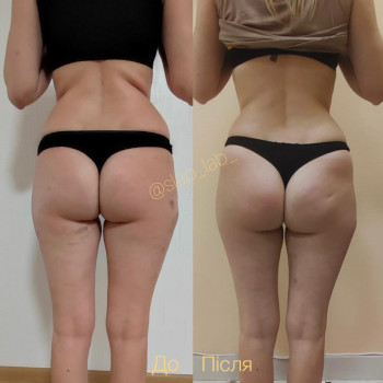 Марія Хропункова, Одеса Фото - 36