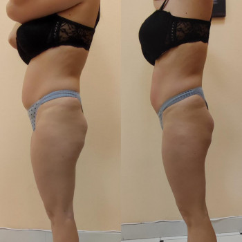 Марія Хропункова, Одеса Фото - 38