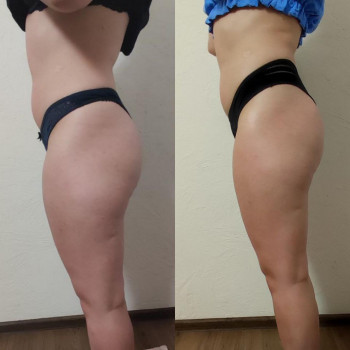 Марія Хропункова, Одеса Фото - 39