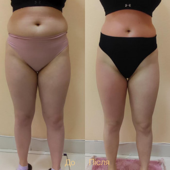 Марія Хропункова, Одеса Фото - 41