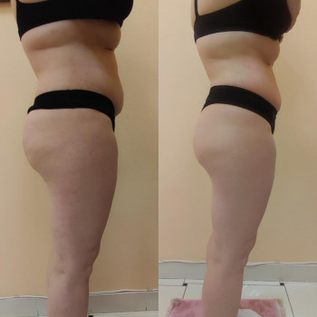 Марія Хропункова, Одеса Фото - 43