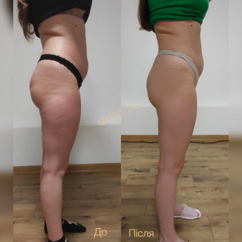 Марія Хропункова, Одеса Фото - 45