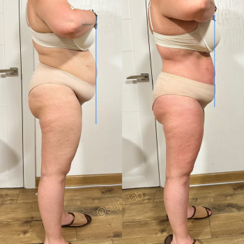 Марія Хропункова, Одеса Фото - 46