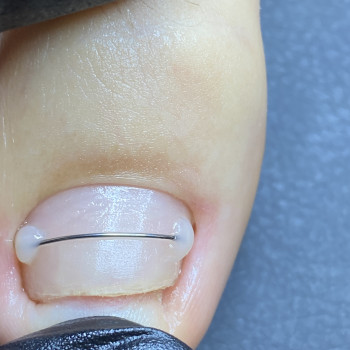 Елена Плисс , Одеса Фото - 9