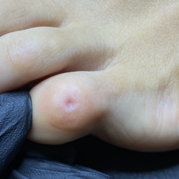 Елена Плисс , Одеса Фото - 14