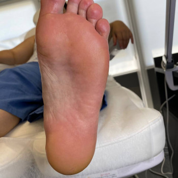 Обробка тріщин
                    Центры подологии Твоя стопа Львов