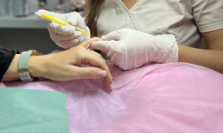 Мезотерапія рук Косметолог Ксенія Ужгород