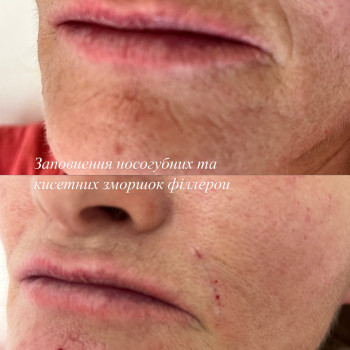 Вікторія Кравченко, Миргород Фото - 3