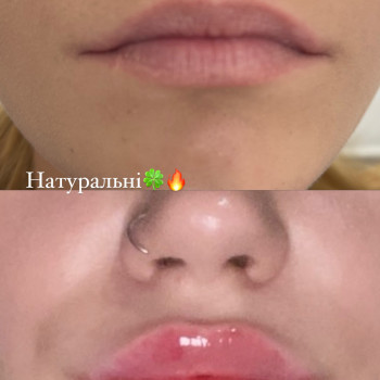 Вікторія Кравченко, Миргород Фото - 4