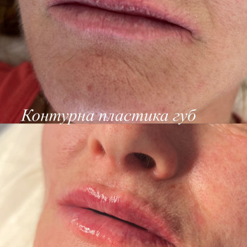 Вікторія Кравченко, Миргород Фото - 6