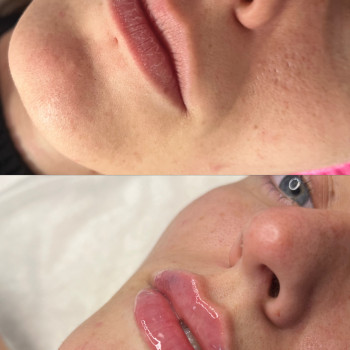 Вікторія Кравченко, Миргород Фото - 7