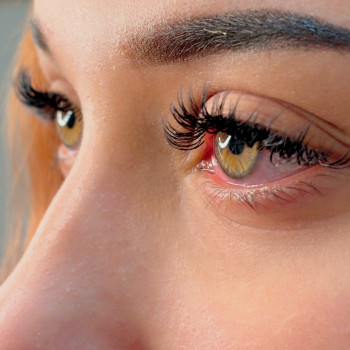 Нарощення вій мокрий ефект з 2Д


 
 
 