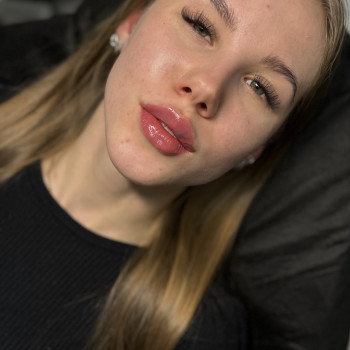 Контурна пластика губ
                    Врач-косметолог Юлия Киев