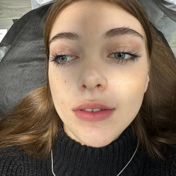 Контурна пластика губ
                    Врач-косметолог Юлия Киев