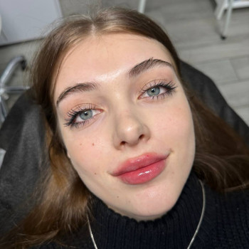 Контурна пластика губ
                    Врач-косметолог Юлия Киев