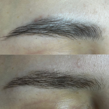 Видалення перманенту/татуажу
                    Мастер перманентного макияжа Аня Ужгород