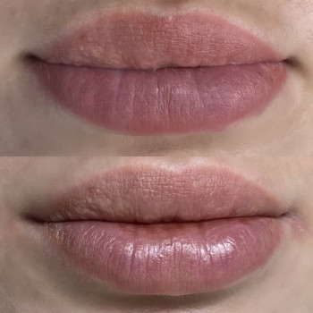 Видалення перманенту/татуажу
                    Мастер перманентного макияжа Аня Ужгород