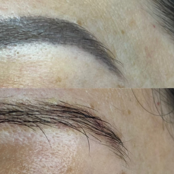 Видалення перманенту/татуажу
                    Мастер перманентного макияжа Аня Ужгород