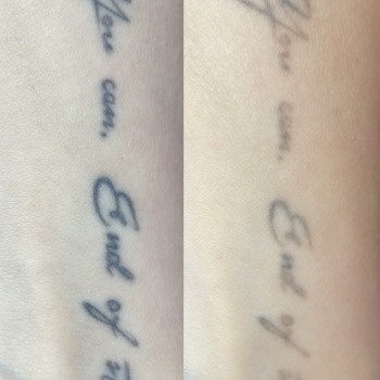 Аня Лукач, Ужгород Фото - 5