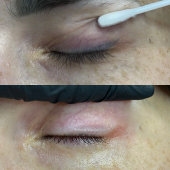 Аня Лукач, Ужгород Фото - 7