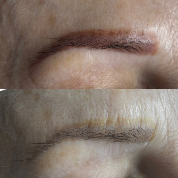 Аня Лукач, Ужгород Фото - 1