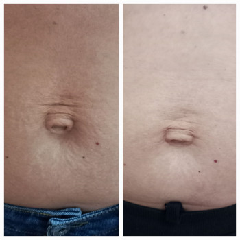 Людмила Патек, Ужгород Фото - 15