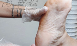 Медичний педикюр - чоловічий, жіночий Нігтьова студія Beautiful nails Івано-Франківськ