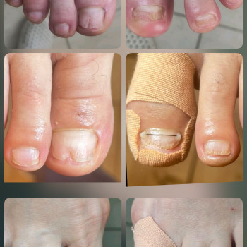   нігтів
  ногтей
 