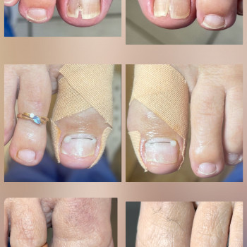   нігтів
  ногтей
 