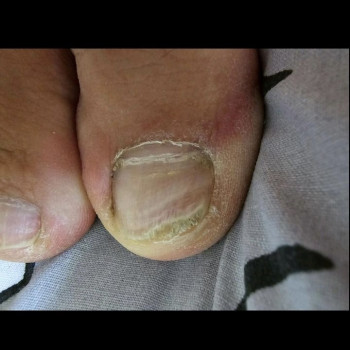 Наталія Бородай, Обухів Фото - 7