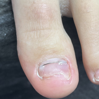 Наталія Бородай, Обухів Фото - 8