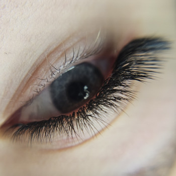 Ефект лисички в вигині С+Л