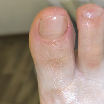 Педикюр
                    Подолог Евгения Киев