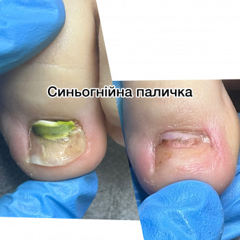 Ірина Дідківська, Ірпінь Фото - 7