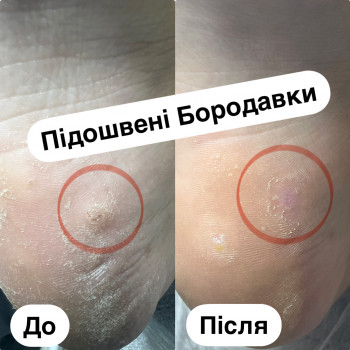 Ірина Дідківська, Ірпінь Фото - 8