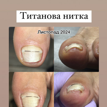 Ірина Дідківська, Ірпінь Фото - 9