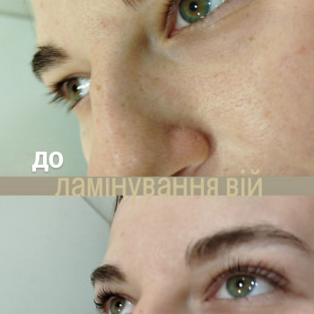 Ламінування вій
                    Мастер депиляции Аліна Каменское