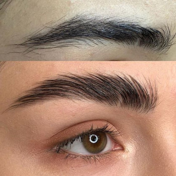 Видалення перманентного макіяжу брів
                    Студия лазерной эпиляции Центр лазерної косметології Луцк