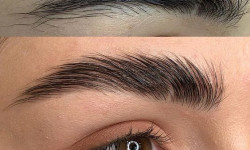 Видалення перманентного макіяжу брів Студія лазерної епіляції Центр лазерної косметології Луцьк