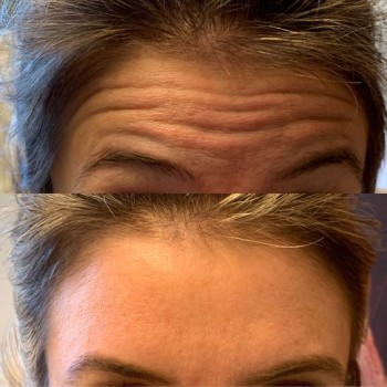 Центр лазерної косметології