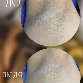 Чоловічі пахви
      