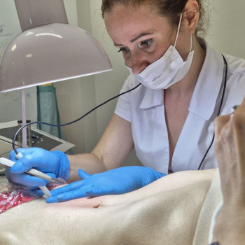 Електроепіляція животик
      